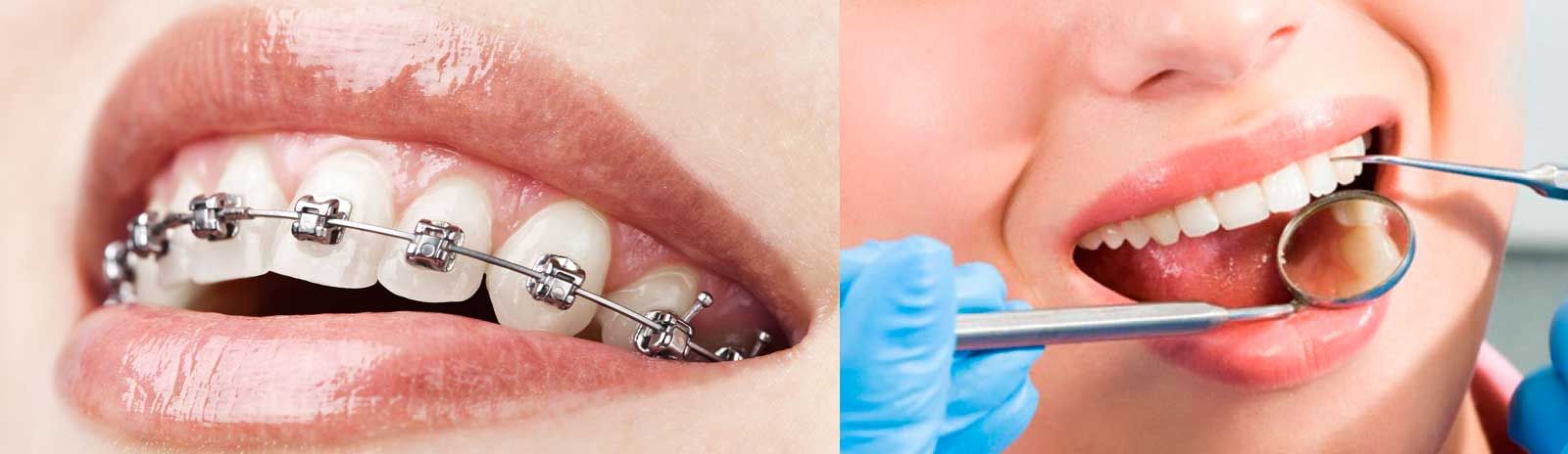 Clínica Dental de Especialidades Doctora Amparo Sierra Alonso procedimientos odontológicos